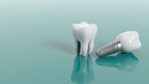 Tooth and dental implant isolated on green background.